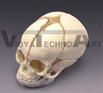 Fetal Skull